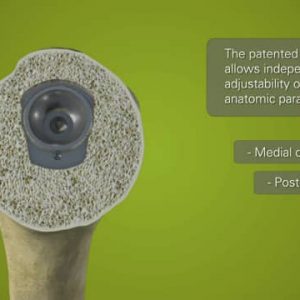 Exactech Equinoxe Replicator Plate for Total Shoulder Arthroplasty - 718-01-34