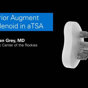 Exactech: Posterior Augment Cage Glenoid in aTSA with Sean Grey, MD - 718-01-04