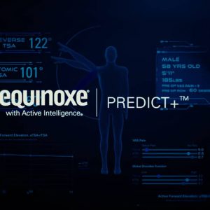 Exactech Equinoxe with Active Intelligence Predict+
